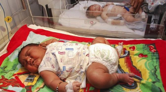 Seorang bayi laki-laki lahir dengan berat mencapai 5 kilogram di Rajasthan, India.