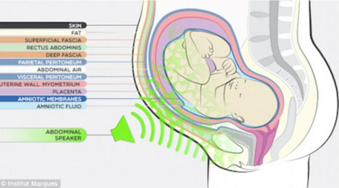 musik dimainkan melalui headphone di sekitar perut ibu hamil