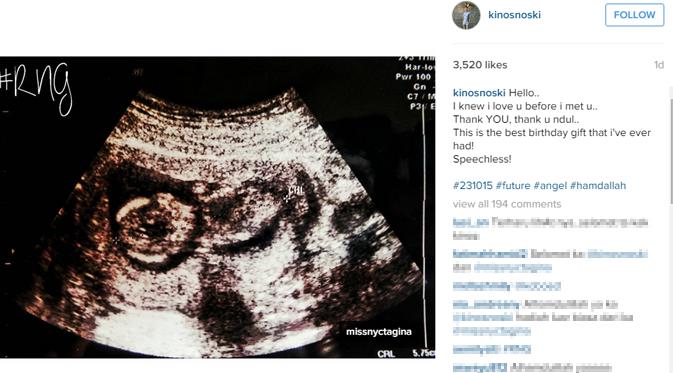 Nycta Gina memberi kado kehamilan pertamanya tepat di hari ulang tahun suaminya. (foto: instagram.com/kinosnoski)