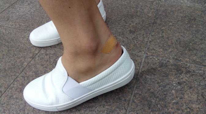 Sering pakai high heels, atas tumit terluka biasa terjadi pada telapak kaki para model catwalk. 