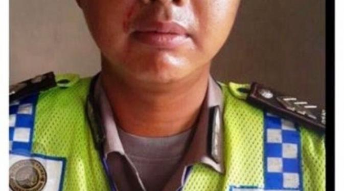 Anggota Polantas Kelapa Gading, Jakarta Utara bernama Brigadir Rustam akhirnya menjalani visum dan melapor ke kepolisian.
