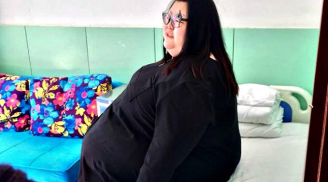 Seorang wanita dengan julukan 'paling gemuk di seluruh Tiongkok' akhirnya menjalani bedah lambung untuk membantunya 'menyusut'.