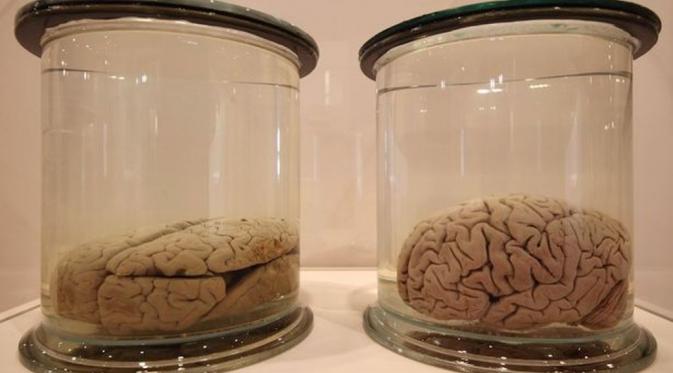 Koleksi otak manusia di Museum Indiana Medical History | via: mirror.co.uk