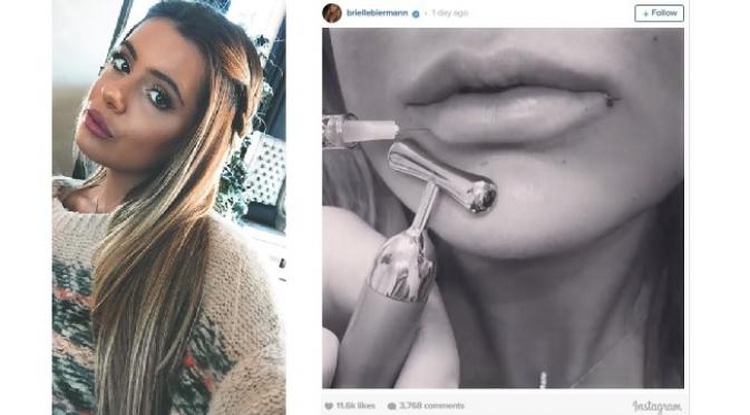 Kim Zolciak-Biermann melakukan operasi bibir yang serupa dengan Kylie Jenner (sumber. Eonline.com)