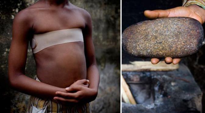 Gunakan Batu Panas, Payudara Para Gadis di Kamerun Diratakan | via: express.co.uk