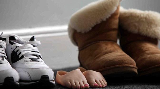 Kehilangan Kaki, Gadis Mungil Ini Tetap Ingin Berjalan dan Menari | via: dailymail.co.uk