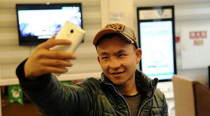 Selfie perdana Li Ming setelah tiga kali menjalani operasi. (Via: mirror.co.uk)