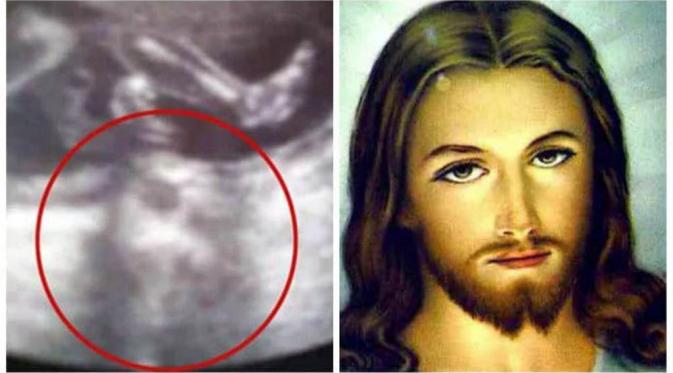 Ada penampakan Yesus di dalam foto USG ini? (CEN/Naij.com)