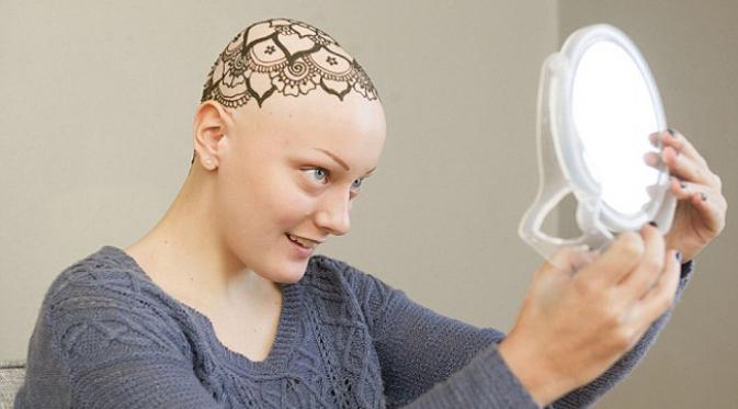 Pasien terakhir Hollie adalah Ava Gagner, gadis remaja pengidap alopecia. (foto: AP)