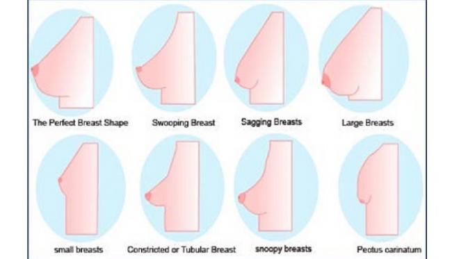 Ragam bentuk dan ukuran payudara (sumber. medindia.net)
