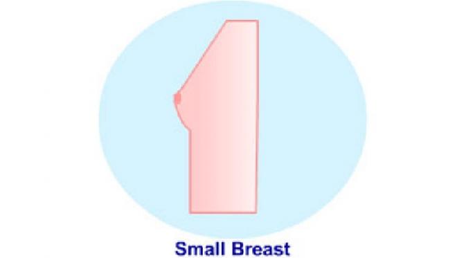  Small Breasts (sumber, medindia.net)