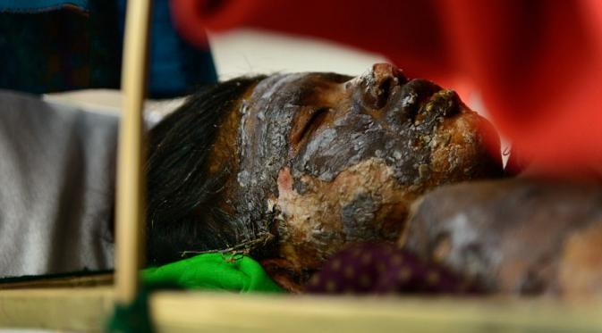 Lawan pemerkosa, gadis malang ini malah dibakar hingga meninggal. | via: Smita Sharma/Redux