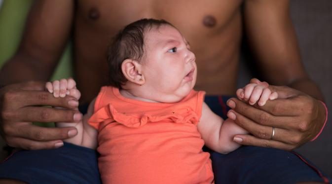 Ibu-ibu di Brazil ketakutan dengan virus Zika yang sudah menyebar. Virus ini mengakibatkan para bayi terlahir dengan kepala kecil. 