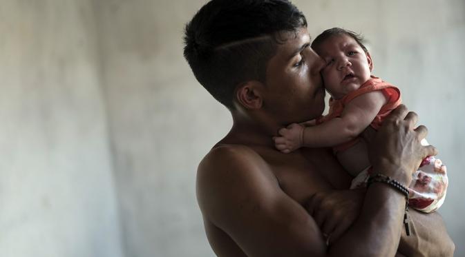 Virus Zika Menyebar, Ribuan Bayi Brasil Lahir dengan Kepala Kecil | via: latincorrespondent.com