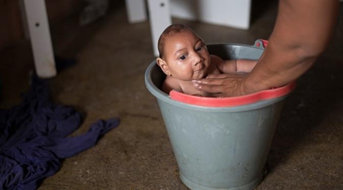 Solange Ferreira memandikan anaknya Jose Wesley, yang lahir dengan mikrosefali, di rumah mereka di Poco Fundo, Brasil pada 23 Desember 2015. (Via: theguardian.com)