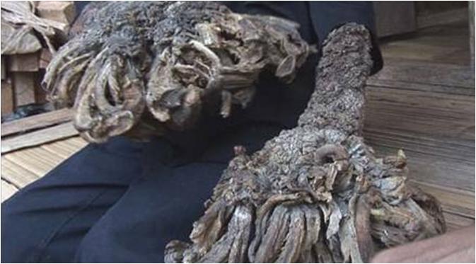 Dede Manusia Akar a.k.a Dede Koswara mengalami gangguan langka yang membuatnya tampak seperti akar pohon (via istimewa)