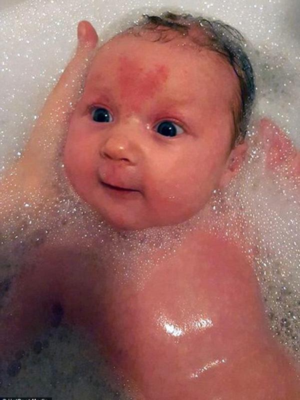 Poppy Rae sedang mandi. Tanda lahir bentuk hatinya makin terlihat jelas | Via: dailymail.co.uk