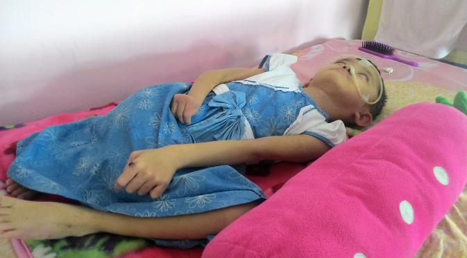 Zoe Lydia (10) harus berjuang seorang diri melawan penyakit hidrosefalus dan epilepsi yang dideritanya (Liputan6.com/Achmad Sudarno)