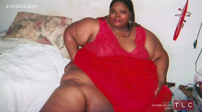  Obesitas, Perempuan Ini Tak Pernah Bergerak Selama 2 Tahun | via: thesun.co.uk