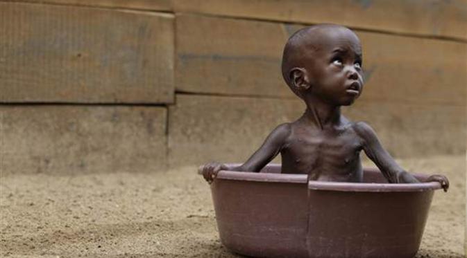 Ilustrasi anak Zimbabwe yang kelaparan. (niketalk.com)