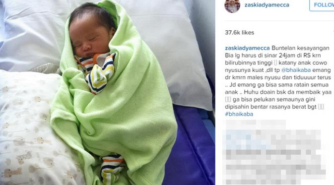 Anak Zaskia Mecca alami bilirubin (Instagram)
