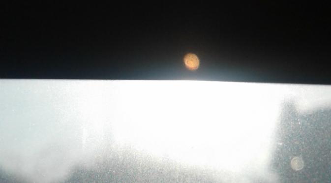 Saat foto rontgen di arahkan ke depan matahari, para ibu dapat melihatnya pada negatif foto yang berwarna lebih gelap.