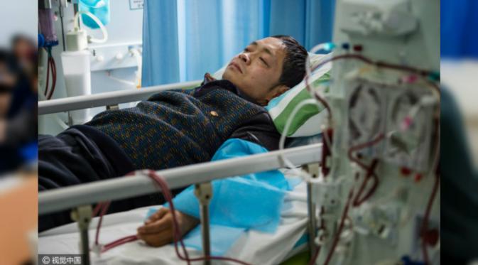 Untuk bertahan hidup, Yu harus melakukan hemodialisis tiga kali seminggu selama satu tahun setengah, sementara menantikan transplantasi ginjal. (Shanghaiist)