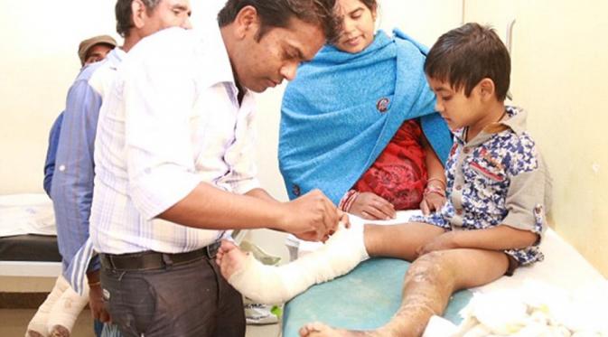 Dinkal Patel dipasangi perban oleh dokter untuk mencegah infeksi yang lebih parah. (Caters News Agency)