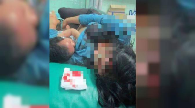 Foto seorang ibu memberikan ASI kepada anaknya sambil menunggu dirawat dokter merebak di dunia maya. (dailymail)