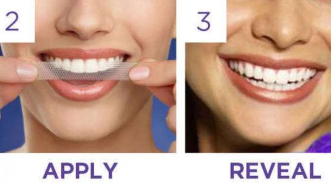 Simak Ini, Cara Paling Efektif Memutihkan Gigi. Sumber : cosmopolitan.com