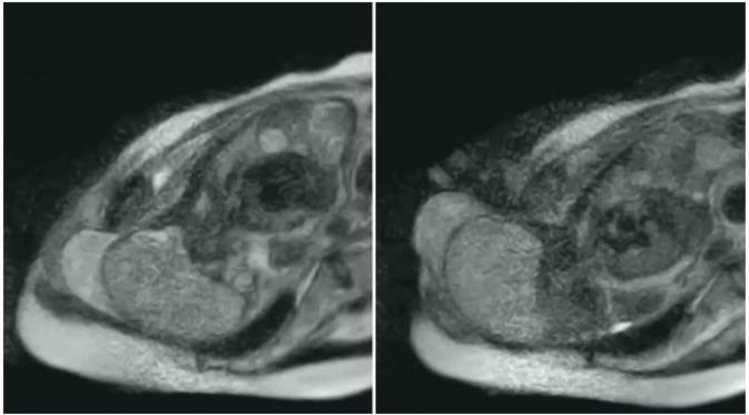 Kelahiran bayi direkam menggunakan mesin MRI. (Sumber cuplikan video Vox)