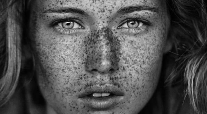 Freckles Muncul di Wajah Karena Alasan Ilmiah, Simak di Sini. Sumber : marieclaire.com