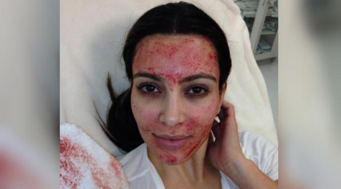 Kim Kardashian sedang melakukan facial darah (Kim Kardashian).