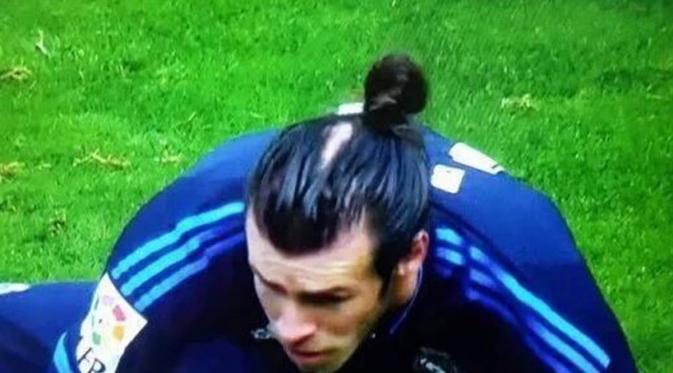 Gareth Bale ternyata mengalami kebotakan / Estaticos