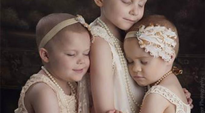 3 gadis kecil pejuang kanker. Foto: Today.com