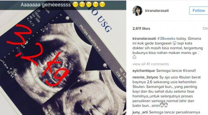 Kirana Larasati mengunggah foto hasil USG kehamilannya yang diperkirakan berat bayinya 3,2 kilogram (Instagram/@kiranalarasati)