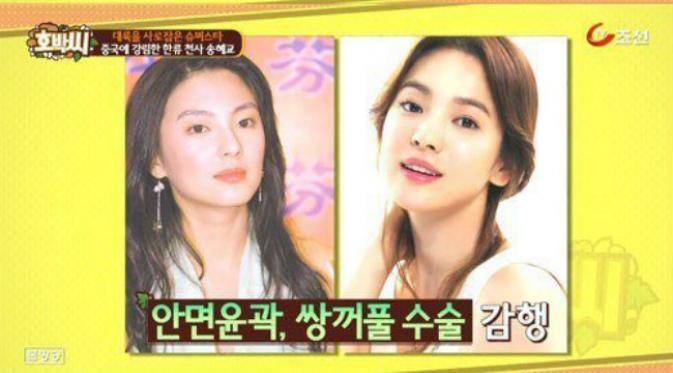 Aktris asal Cina jalani operasi plastik demi wajah seperti Song Hye Gyo. Sumber: Koreaboo.com