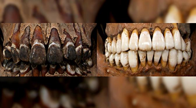 Tradisi Ohaguro Jepang, praktik menghitamkan gigi yang menyimbolkan kecantikan (sumber:peterbrown-palaeonthology)