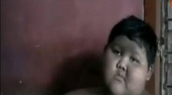 Bukan karena biaya, tapi karena obesitas bocah Karawang yang pintar ini berhenti sekolah. 