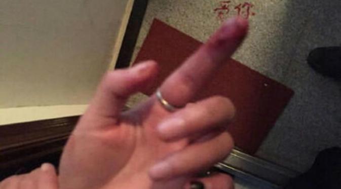 Ia menulis pesan tersebut menggunakan darah yang keluar dari ujung jarinya (Shanghaiist)