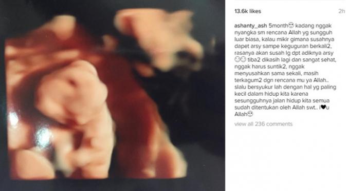 Ashanty ungkap rasa syukur tengah mengandung lima bulan buah hati keduanya. (Instagram)