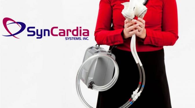 Jantung buatan yang dipasang menanti donor jantung sungguhan (Syncardia)