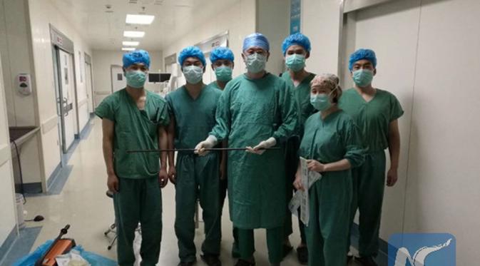 Operasi dilakukan selama 7 jam dan pria itu telah siuman pada Kamis 16 Juni 2016 (news.xinhuanet.com).