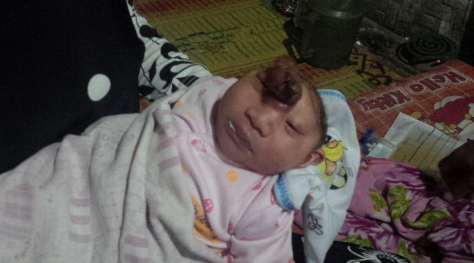 Meski tanpa tempurung kepala, bayi Acim bisa nyenyak tidur di gendongan neneknya. (Liputan6.com/Yandhi Deslatama)