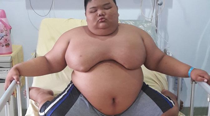 Kondisi Rizki, bocah obesitas asal Palembang itu kini dibantu mesin ventilator. (Liputan6.com/Nefri Inge)