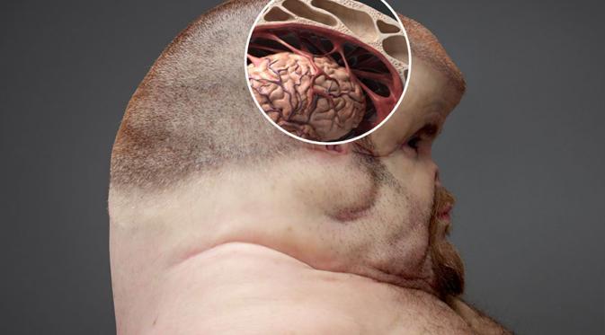 Graham punya otak sama seperti manusia, tapi tempurungnya lebih besar untuk melindungi otaknya dari benturan. (Via: boredpanda.com)