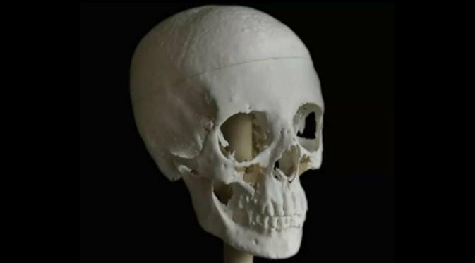 Cetak 3D tengkorak mumi yang dijadikan dasar untuk merekonstruksi wajah (Paul Burston)