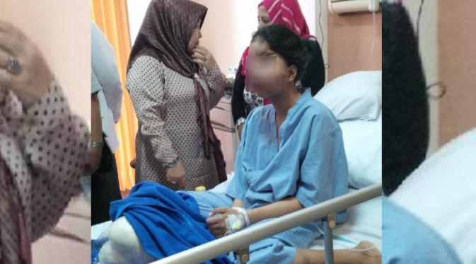 Gadis 16 tahun asal Desa Urang Gantung, Kecamatan Sukodono, Lumajang, Jawa Timur, mengalami kelainan cacat wajah bawaan sejak lahir. (Liputan6.com/Dian Kurniawan) 