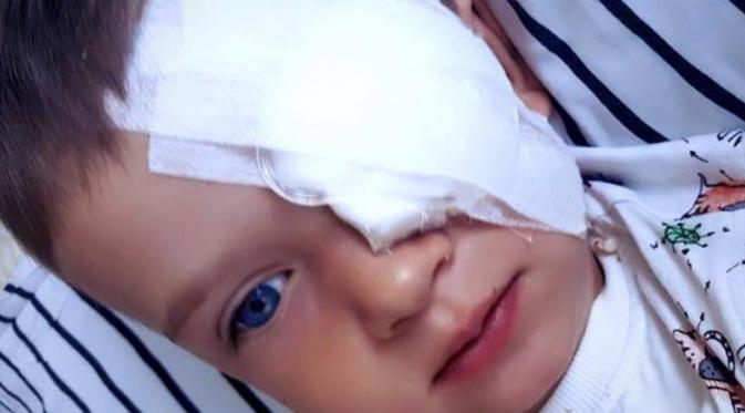 Olek Szymanski, bocah 3 tahun yang menderita kanker mata (Foto: Facebook)