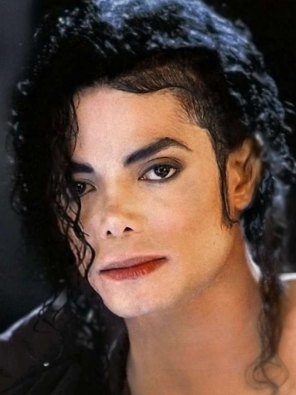 Michael Jackson, Menderita Lupus, Selebriti Ini Senasib dengan Selena Gomez. (Foto: howtobeanexpertlupuspatient.com)